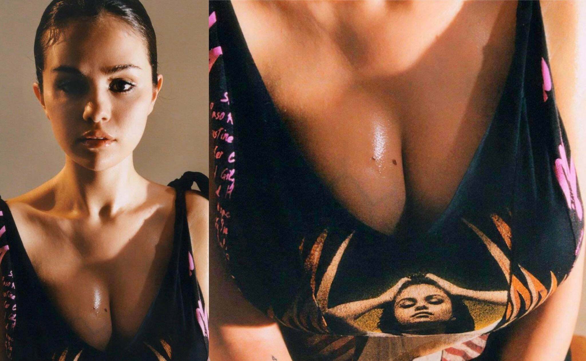 Selena Gomez has veiny breasts