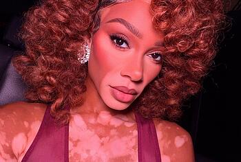 Winnie Harlow Nude And Hot See Through Pics