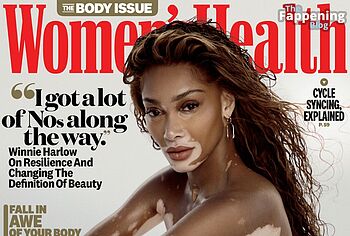 Winnie Harlow Nude And Hot See Through Pics