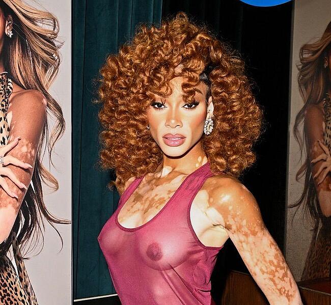 Winnie Harlow nude