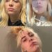 Billie Eilishs plump lips look like theyd give the best
